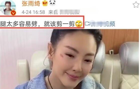 張雨綺剪八爪魚疑內涵羅志祥,羅志祥向周揚青道歉